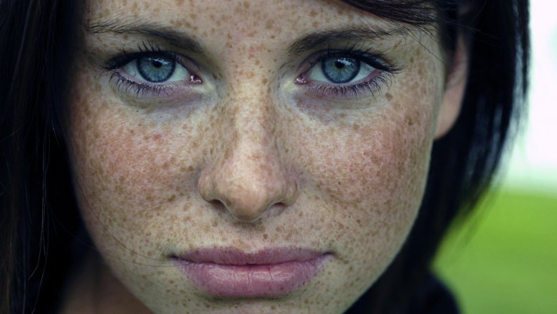 freckles.jpg